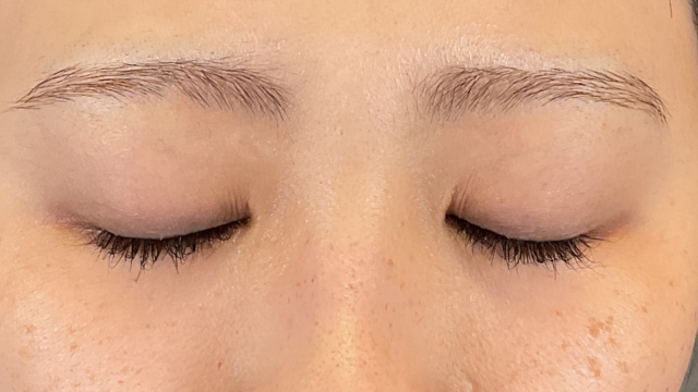 Preoperative Condition Part 1