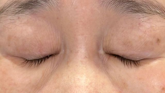 Preoperative Condition Part 1