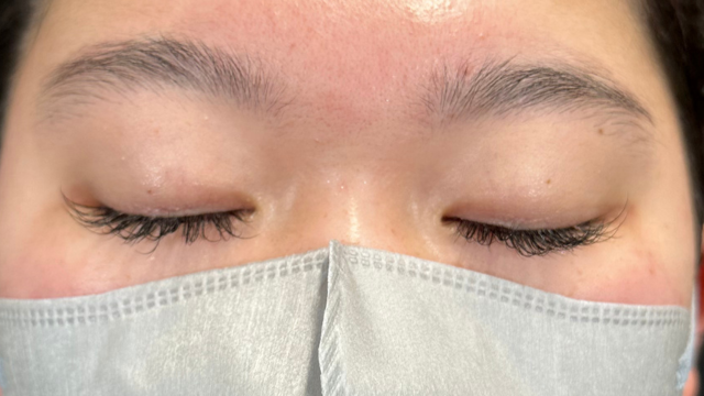 Preoperative Condition Part 1