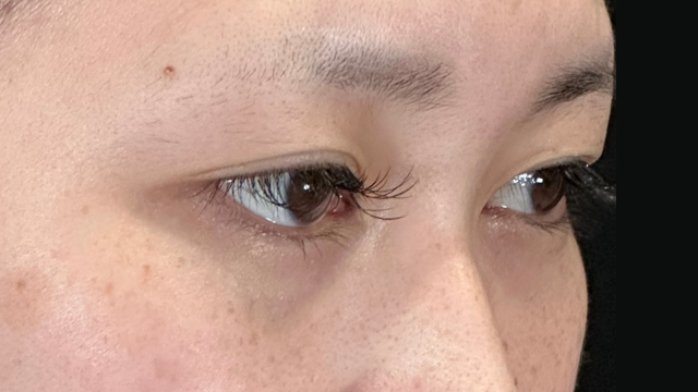 Preoperative Condition Part 1