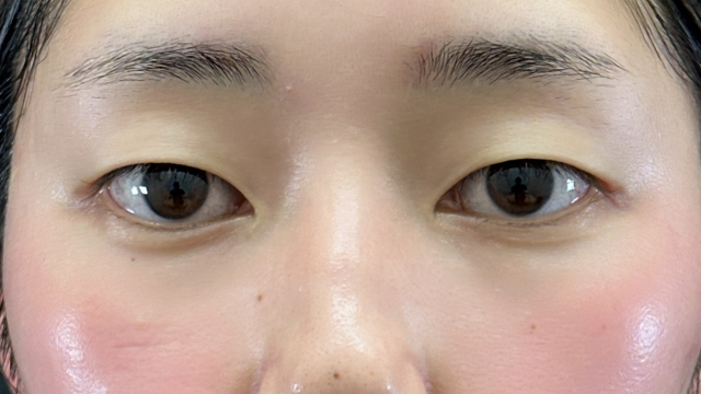 Preoperative Condition Part 1