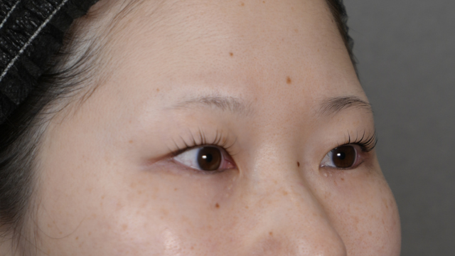 Preoperative Condition Part 1