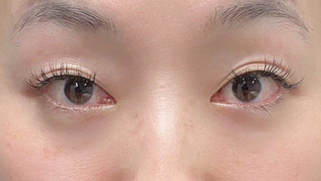 Preoperative Condition Part 1