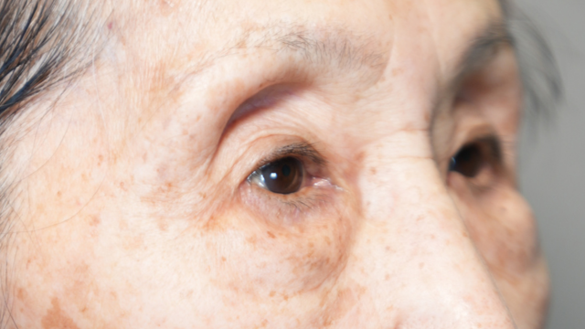 Preoperative Condition Part 1