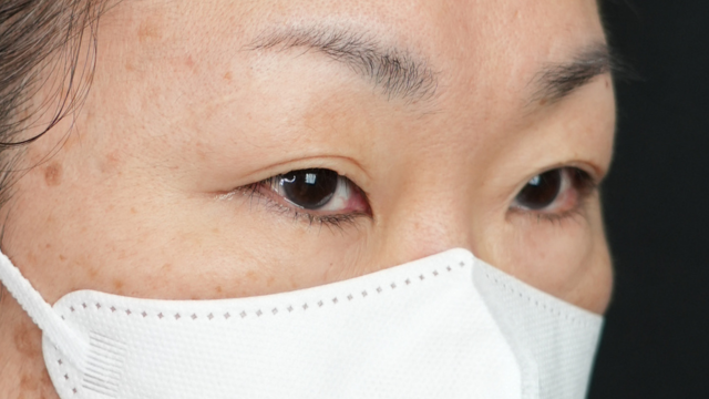 Preoperative Condition Part 1