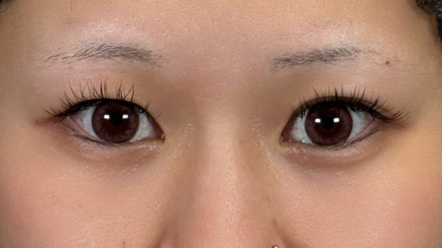 Preoperative Condition Part 1