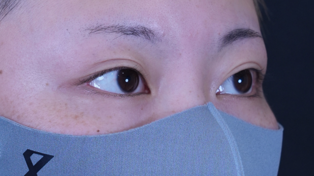 Preoperative Condition Part 1