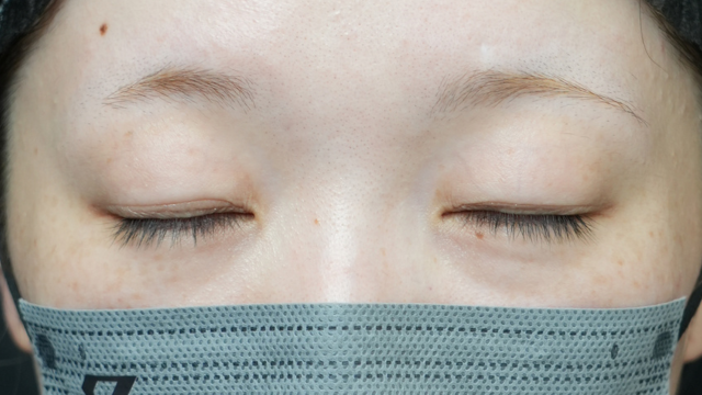 Preoperative Condition Part 1