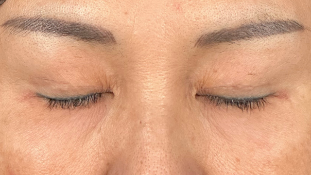 Preoperative Condition Part 1