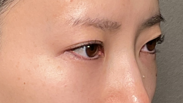 Preoperative Condition Part 1