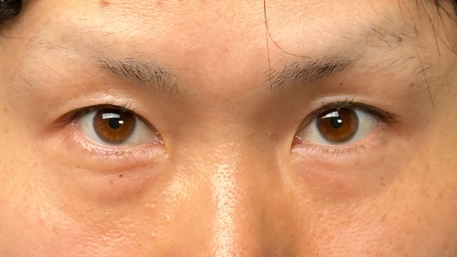 Preoperative Condition Part 1