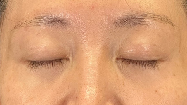 Preoperative Condition Part 1