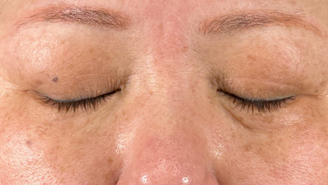 Preoperative Condition Part 1