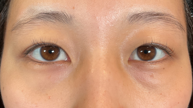 Preoperative Condition Part 1