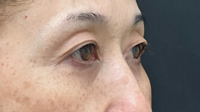 Preoperative Condition Part 1