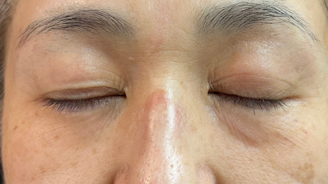 Preoperative Condition Part 1