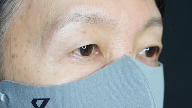 Preoperative Condition Part 1