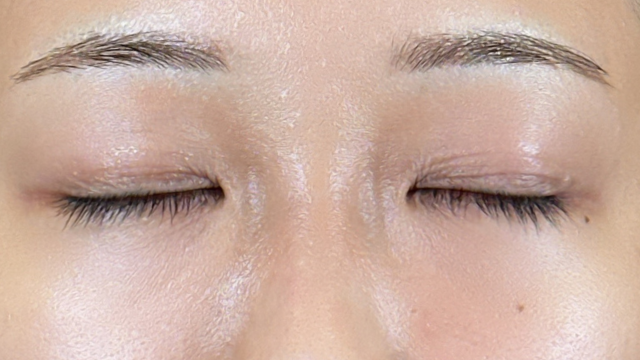 Preoperative Condition Part 1