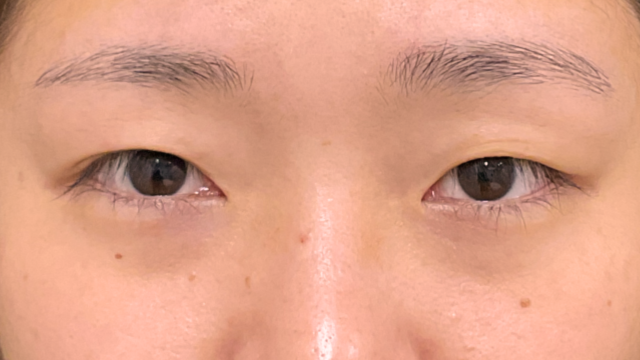 Preoperative Condition Part 1