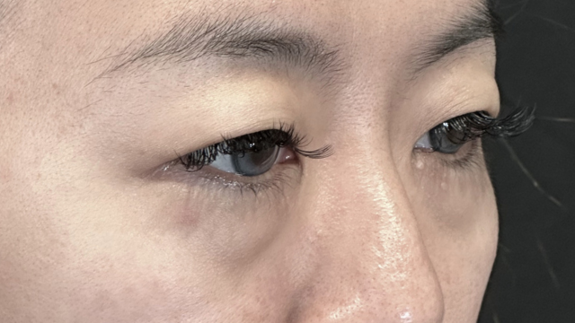 Preoperative Condition Part 1