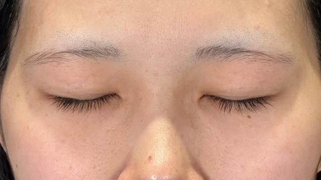 Preoperative Condition Part 1