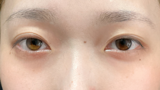 Preoperative Condition Part 1