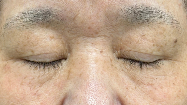 Preoperative Condition Part 1