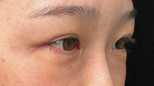 Preoperative Condition Part 1