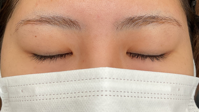 Preoperative Condition Part 1