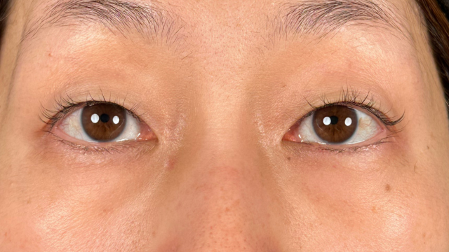 Preoperative Condition Part 1