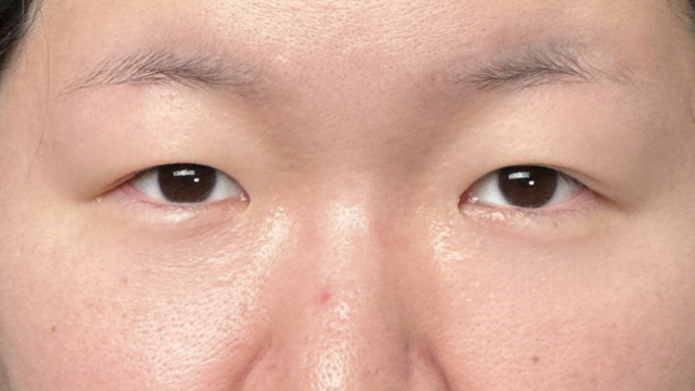 Preoperative Condition Part 1