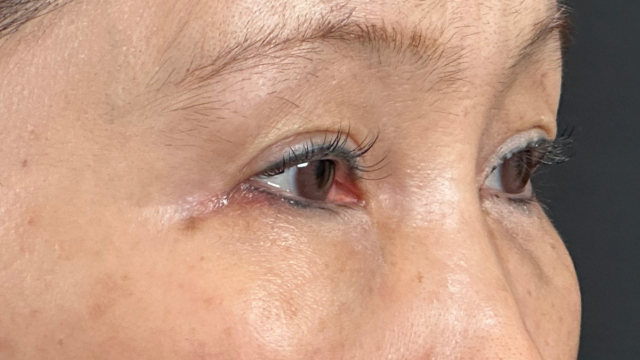 Preoperative Condition Part 1