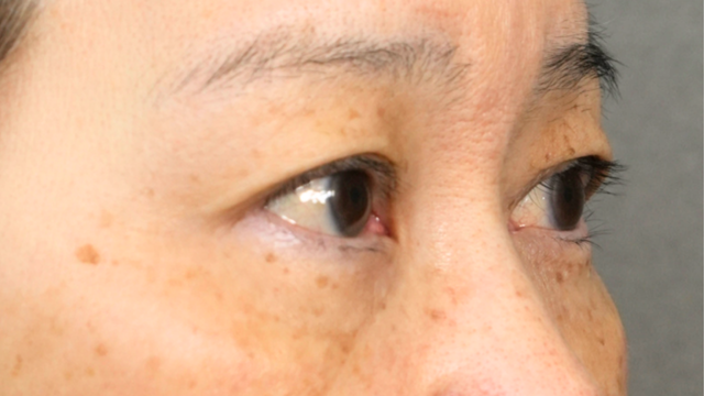 Preoperative Condition Part 1