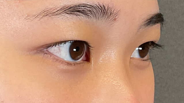 Preoperative Condition Part 1