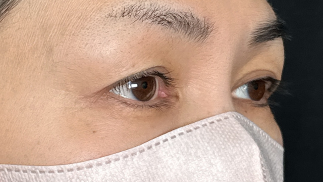 Preoperative Condition Part 1