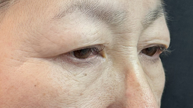 Preoperative Condition Part 1