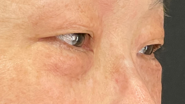 Preoperative Condition Part 1