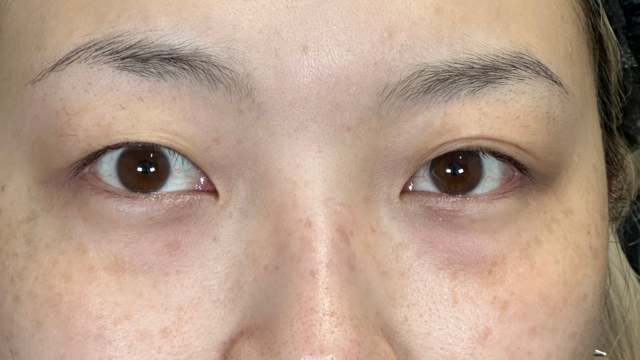 Preoperative Condition Part 1