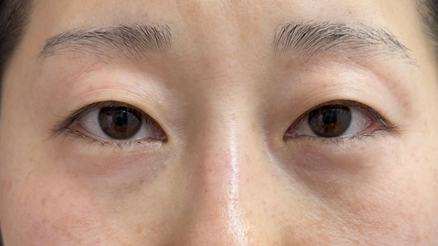 Preoperative Condition Part 1