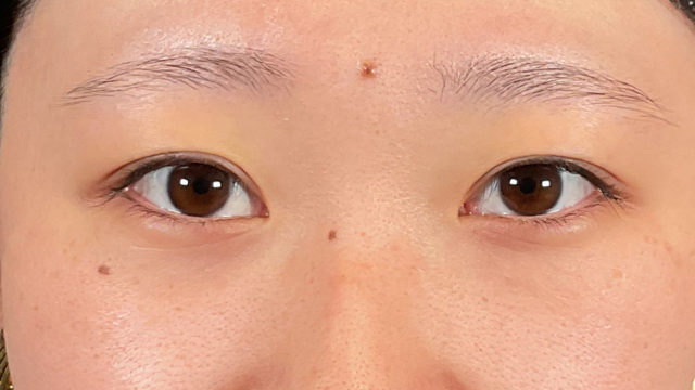 Preoperative Condition Part 1