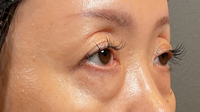 Preoperative Condition Part 1