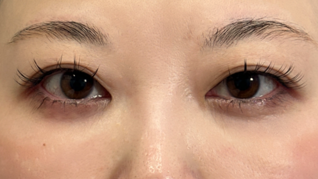 Preoperative Condition Part 1