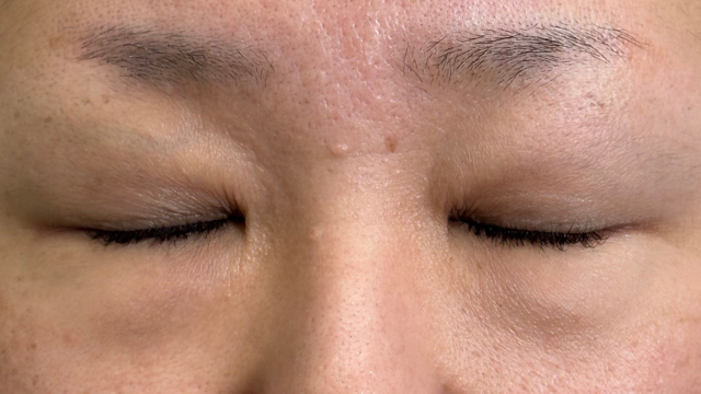 Preoperative Condition Part 1