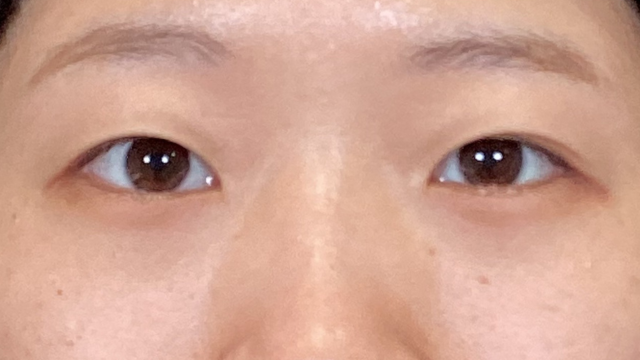 Preoperative Condition Part 1