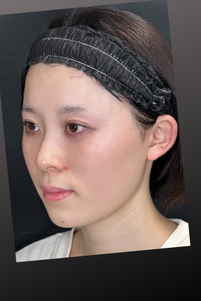 Preoperative Condition Part 1