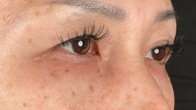 Preoperative Condition Part 1