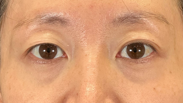 Preoperative Condition Part 1