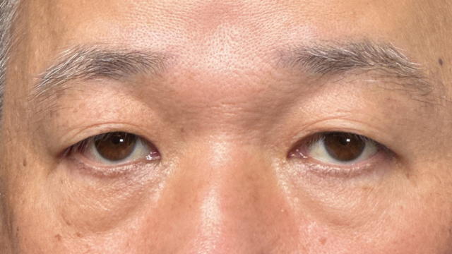 Preoperative Condition Part 1