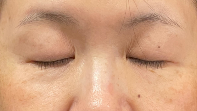 Preoperative Condition Part 1