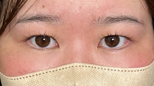 Preoperative Condition Part 1